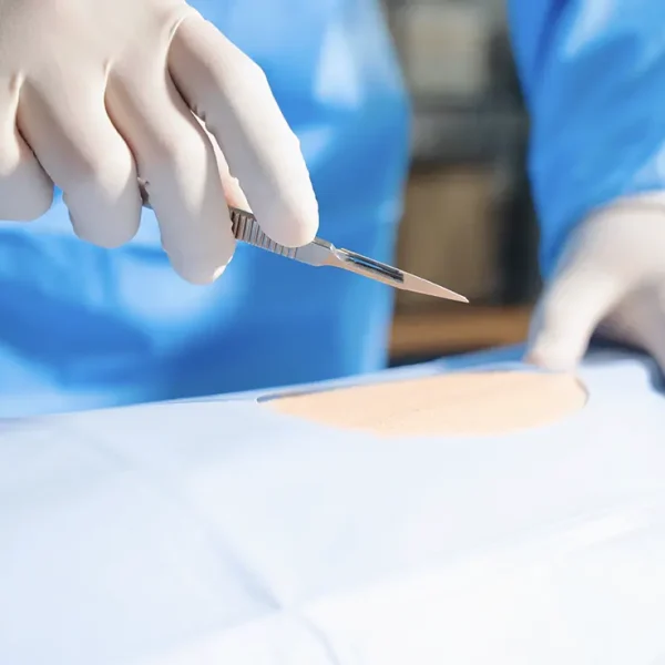 Local Flap Reconstruction2